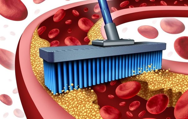 10 суперпродуктов для эффективного очищения артерий и профилактики инфаркта!